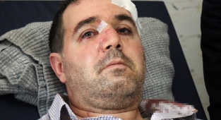 Beni Taciz Ediyorsun Diyerek Doktoru Darp Etti