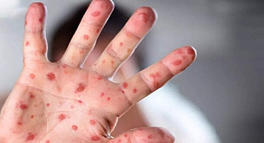 Bilim İnsanlarından Korkutan Maymun Çiçeği Açıklaması