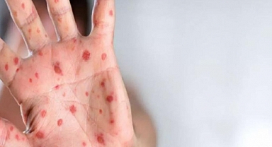 Avrupa'da İlk Ölüm