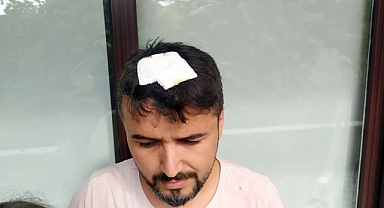 Kafasına Yorgun Mermi İsabet Etti Kızının Gözü Önünde Yere Yığıldı