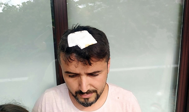 Kafasına Yorgun Mermi İsabet Etti Kızının Gözü Önünde Yere Yığıldı