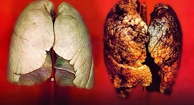 İşte Vücuttaki Nikotini Temizleyen O Besinler