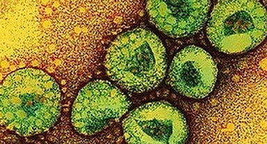 Dünya Tehlike Altında! MERS Virüsü Yayılmaya Başladı