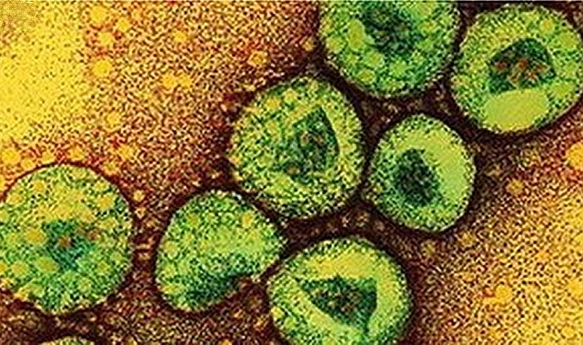 Dünya Tehlike Altında! MERS Virüsü Yayılmaya Başladı