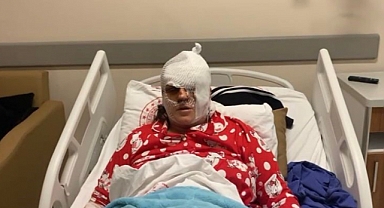 Eski Eşinin Saldırısına Uğrayan Kadın Konuştu: 