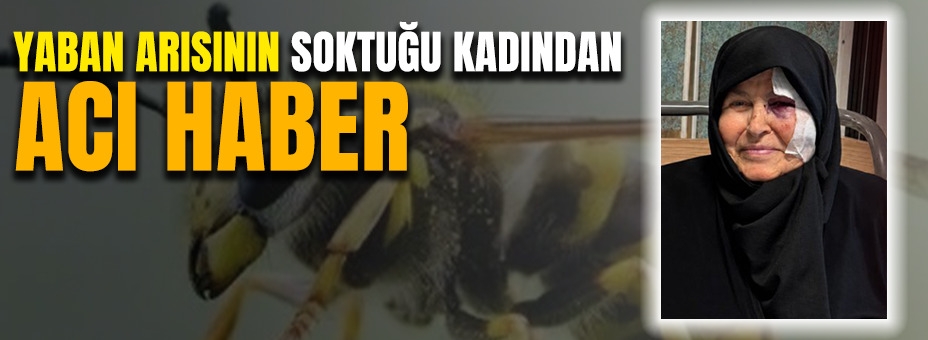 Yaban Arısının Soktuğu Kadından Acı Haber